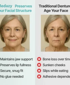 Medazy™ Custom-Fit Full Functional Dentures
