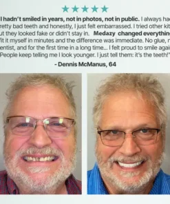 Medazy™ Custom-Fit Full Functional Dentures