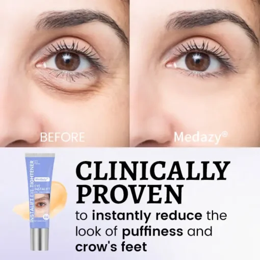 Medazy® InstaLift Eye Tightener