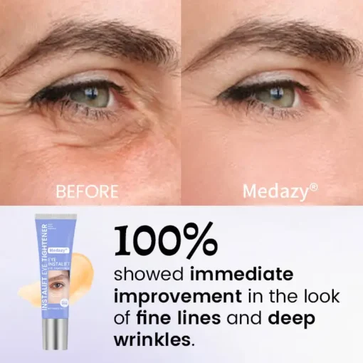 Medazy® InstaLift Eye Tightener
