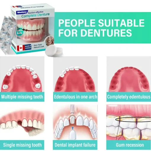 Medazy® Suction-fit Complete Denture