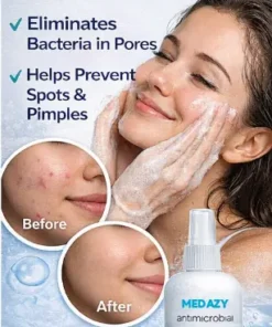 Medazy® Antimicrobial Facial Cleanser Say Goodbye to Breakouts and Hello to Clear Skin