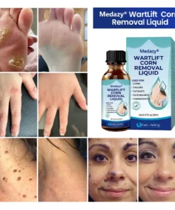 Medazy® WartLift Corn Removal Liquid