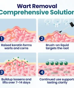 Medazy® WartLift Corn Removal Liquid