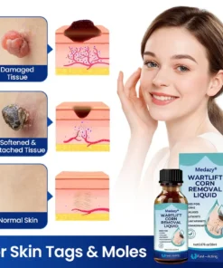 Medazy® WartLift Corn Removal Liquid