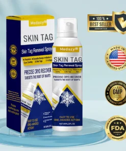 Medazy® Skin Tag Renewal Spray-Reducing nutrient supply to damaged tissue and accelerating its natural shedding process