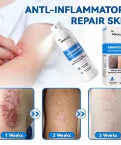 Medazy® Magnesium Herbal Spray