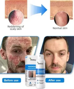 Medazy® Magnesium Herbal Spray