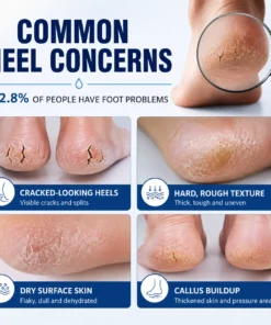 MEDAZY™ Heel Recovery System – Cracked Heel Cream + Moisture-Lock Silicone Socks