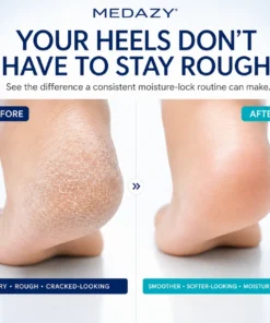 MEDAZY™ Heel Recovery System – Cracked Heel Cream + Moisture-Lock Silicone Socks
